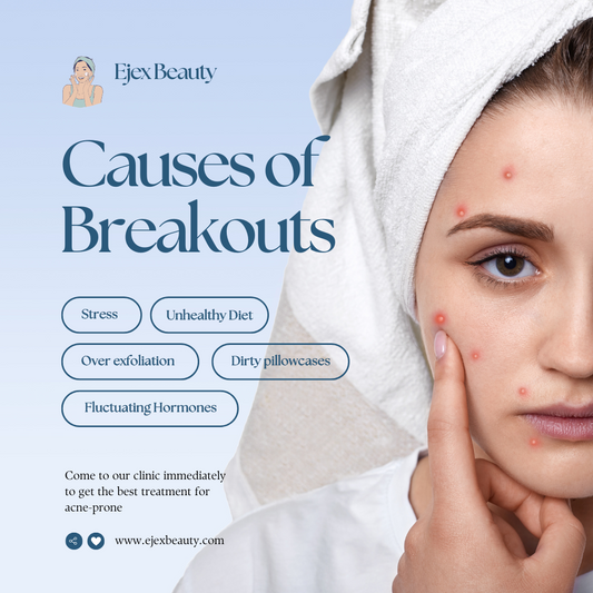 Acne Causes and How Face Masks Can Help Clear Your Skin